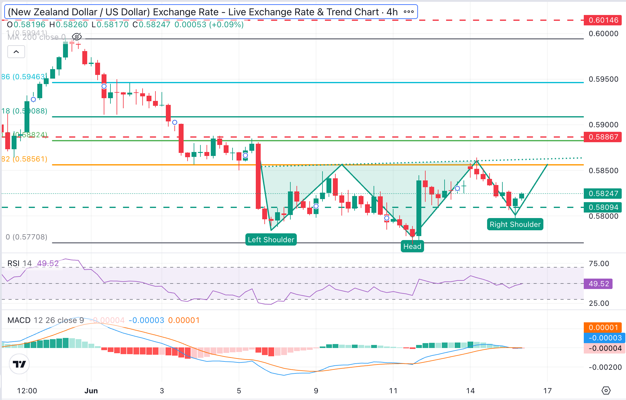 NZD/USD Chart Analysis